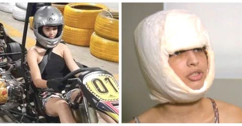 Una joven de 19 años pierde su cuero cabelludo mientras participaba en un torneo de karting