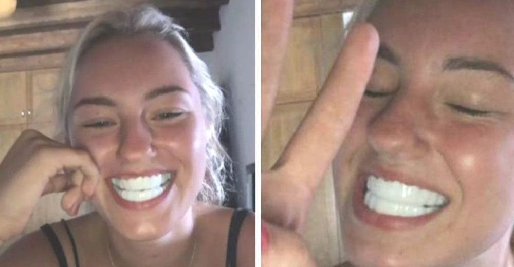 Solo quería lucir una sonrisa perfecta pero terminó estafada y siendo objeto de burlas Solo quería lucir una sonrisa perfecta pero terminó estafada y siendo objeto de burlas