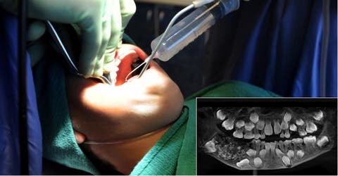 Un niño de 7 años tenía fuertes dolores de mandíbula–El escáner reveló un caso único en el mundo