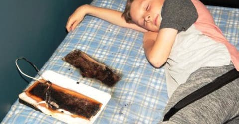 La Tablet de un niño de 11 años se quema en su cama mientras dormía muy cerca de su rostro