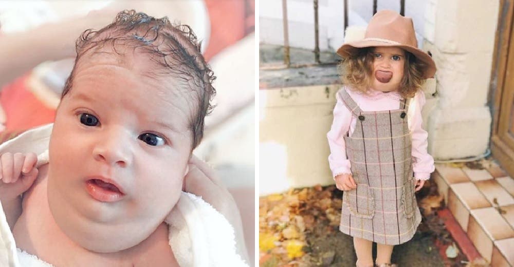 Celebran el cumpleaños de una niña a la que los médicos no le dieron ni un día de vida Celebran el cumpleaños de una niña a la que los médicos no le dieron ni un día de vida