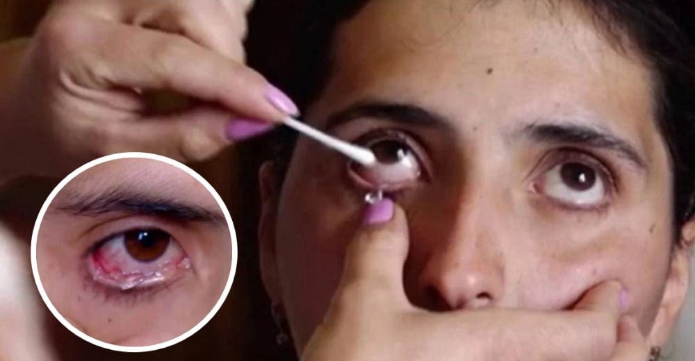 El curioso caso de la joven que llora lágrimas de cristal mantiene a los médicos desconcertados El curioso caso de la joven que llora lágrimas de cristal mantiene a los médicos desconcertados