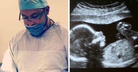El vídeo viral del bebé que sorprende al médico jugando en el vientre de su madre