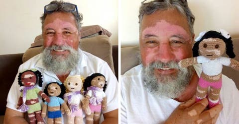 Un amoroso abuelo crea muñecas con vitíligo para que su pequeña nieta pueda jugar