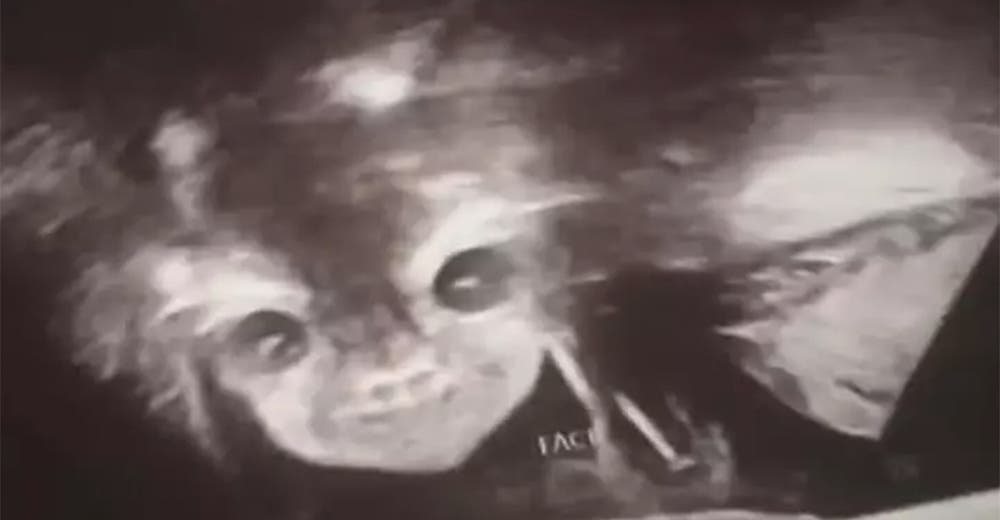 Una madre termina aterrada y sorprendida al ver la imagen de la ecografía de su bebé Una madre termina aterrada y sorprendida al ver la imagen de la ecografía de su bebé
