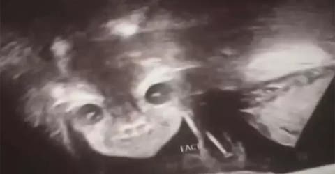 Una madre termina aterrada y sorprendida al ver la imagen de la ecografía de su bebé