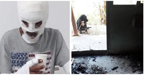 Un joven salva a 8 perros de un devastador incendio y termina con graves quemaduras