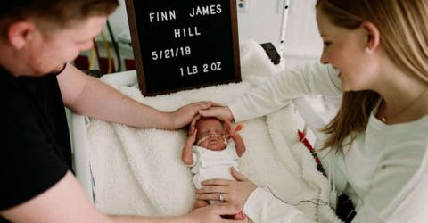 La Transformacion Del Bebe Que Nacio Prematuro Pesando 500 Gramos Tras Perder A Su Hermanito Viralistas Com La Transformacion Del Bebe Que Nacio Prematuro Pesando 500 Gramos Tras Perder A Su Hermanito Viralistas Com