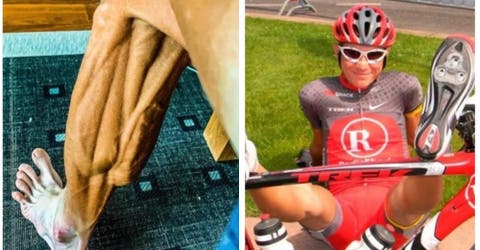 Cuenta la dramática realidad detrás de la foto de sus músculos al retomar el ciclismo