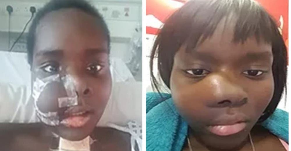 La operan para extraer el tumor que deformó su rostro y le quitó la esperanza de lograr su sueño La operan para extraer el tumor que deformó su rostro y le quitó la esperanza de lograr su sueño