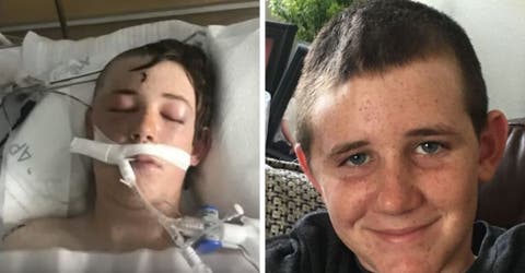 Un niño de 14 años sobrevive de milagro después que un ancla perforara su cabeza
