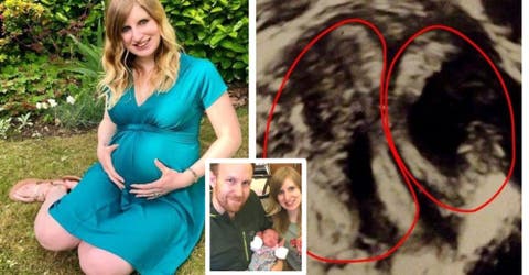 La mujer con 2 vaginas y 2 úteros da a luz contra todo pronóstico médico