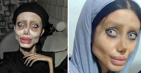 La mujer que se operó 50 veces para parecerse a Angelina Jolie acaba entre rejas