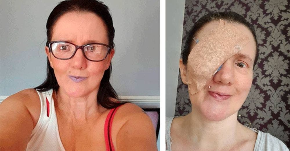 «Sentí dolor y un estallido» – Se saca la córnea mientras se secaba el rostro con una toalla «Sentí dolor y un estallido» – Se saca la córnea mientras se secaba el rostro con una toalla