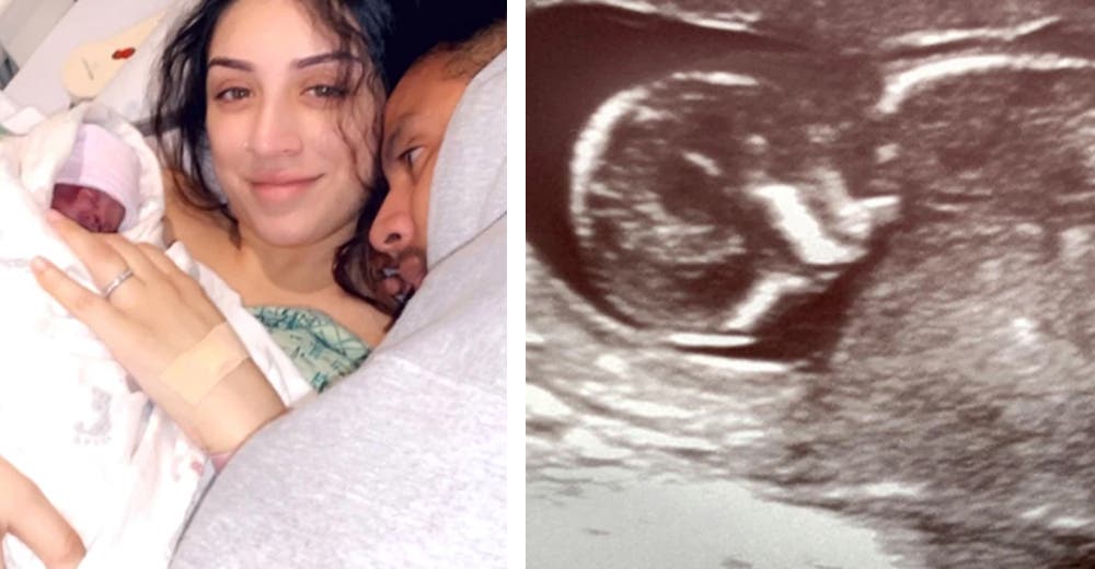«No le deseo esto a nadie» – Le hacen una cesárea sin anestesia para intentar salvar a su bebé «No le deseo esto a nadie» – Le hacen una cesárea sin anestesia para intentar salvar a su bebé