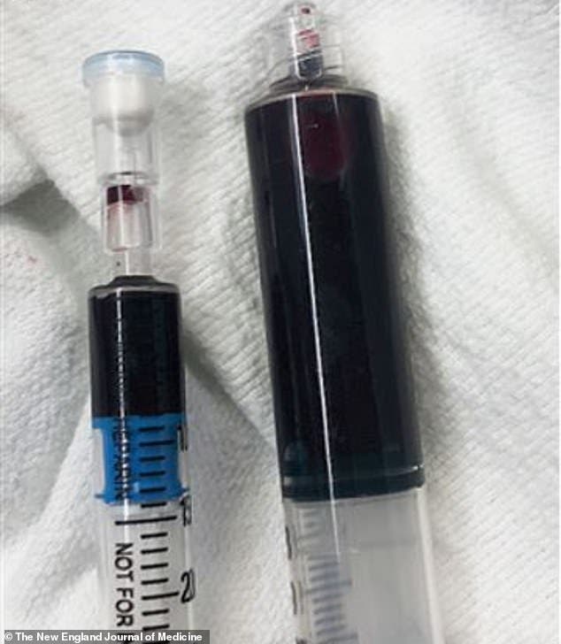 Una mujer termina con la sangre azul tras automedicarse para aliviar un