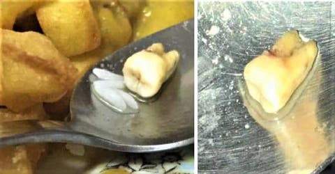 El drama de una pareja que encontró un diente humano en su plato de comida