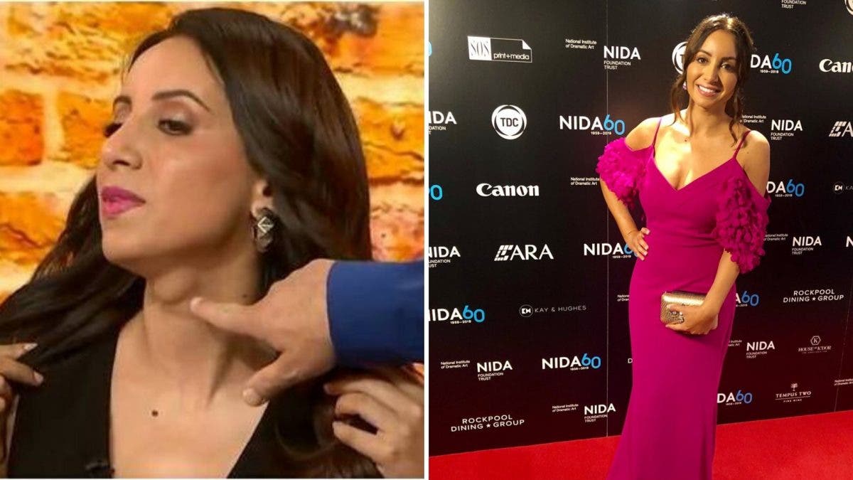 Una presentadora termina en el hospital tras ser advertida sobre el bulto que tenía en su cuello