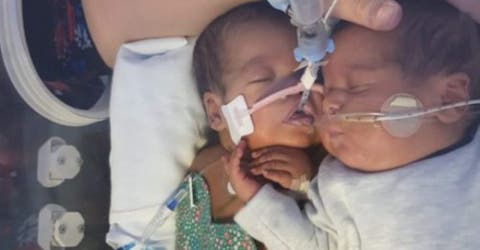 El abrazo de su hermano gemelo lo salva cuando estaba a punto de morir en la incubadora
