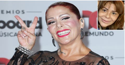 Alejandra Guzmán se convierte en blanco de críticas por sus cirugías fallidas en su rostro
