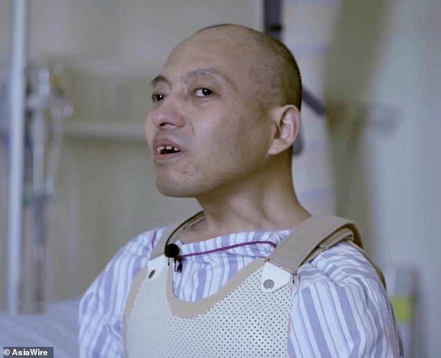 El "hombre plegable" se pone de pie tras 28 años con su cara presionada