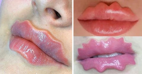 La peligrosa moda estética que está revolucionando las redes: «Labios del diablo»