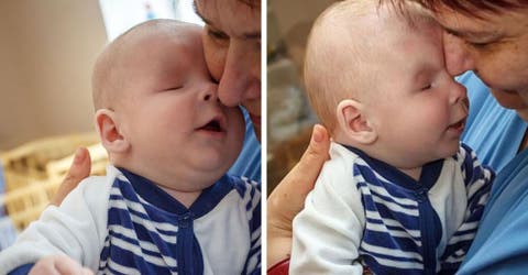El bebé que no quisieron sus padres por nacer sin ojos finalmente encuentra un hogar en Navidad
