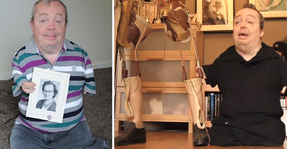 Nace sin extremidades por culpa de un fármaco pero le niegan la ayuda que necesita