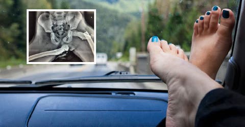 Con una impactante imagen advierten el grave peligro de posar los pies sobre el tablero del auto