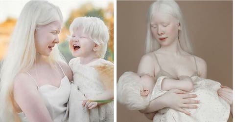 Las hermanas albinas con 12 años de diferencia impresionan a todos – «No saben quiénes somos»