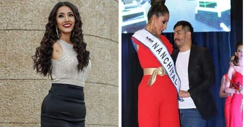 Se convierte en la primera modelo sin brazos que gana un concurso de belleza