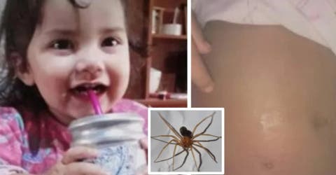 La picadura de un animal deja a una niña de 3 años ingresada en cuidados intensivos