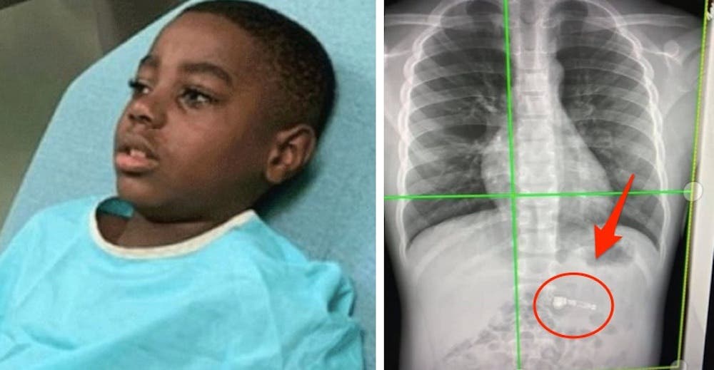 «Tengo miedo mamá” – Un niño de 7 años termina en el hospital tras tragarse su regalo de Navidad «Tengo miedo mamá” – Un niño de 7 años termina en el hospital tras tragarse su regalo de Navidad