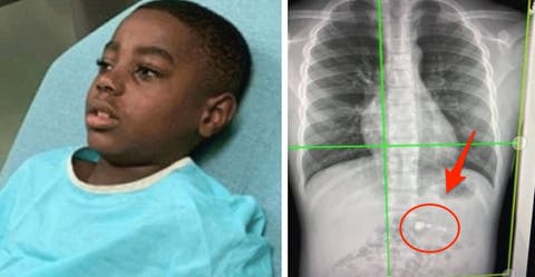 «Tengo miedo mamá” – Un niño de 7 años termina en el hospital tras tragarse su regalo de Navidad