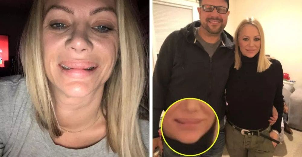 El drama de la mujer que desea recuperar el rostro que tenía antes de sus fracasadas cirugías El drama de la mujer que desea recuperar el rostro que tenía antes de sus fracasadas cirugías