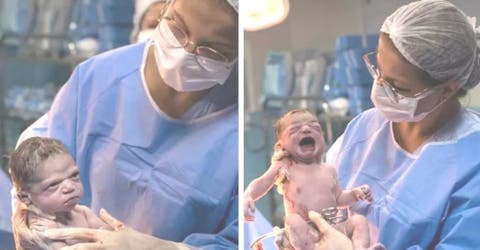 La historia de la foto viral de la bebé recién nacida que está muy enojada con el médico