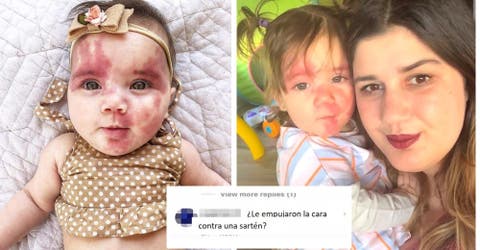 La madre de una bebé responde a quienes comentan sobre la apariencia de su hija