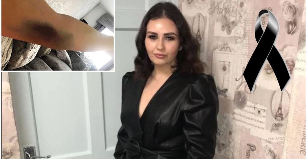 Acude al médico alarmada por sus raros hematomas y muere una semana después Acude al médico alarmada por sus raros hematomas y muere una semana después