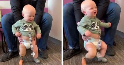 La reacción del niño que puede ponerse de pie por primera vez con su nueva prótesis
