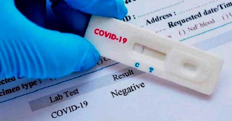 Los detalles de la nueva prueba que diagnostica el coronavirus en 15 minutos