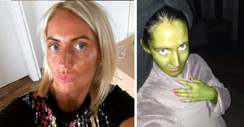 El drama de la mujer que terminó con la piel verde tras aplicarse su producto de belleza favorito