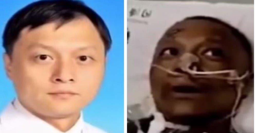 El coronavirus oscurece la piel de 2 pacientes alarmando a la comunidad científica El coronavirus oscurece la piel de 2 pacientes alarmando a la comunidad científica