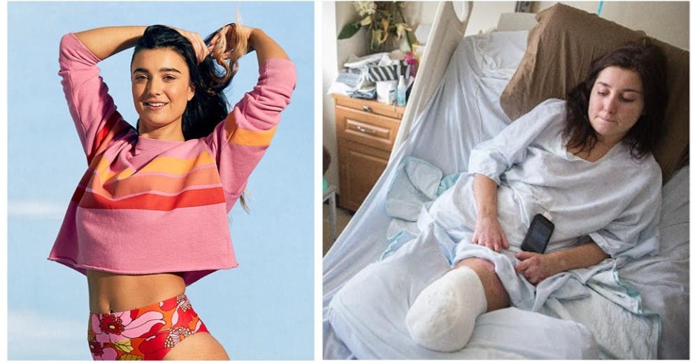 A pesar de haber perdido una pierna se convierte en campeona olímpica A pesar de haber perdido una pierna se convierte en campeona olímpica