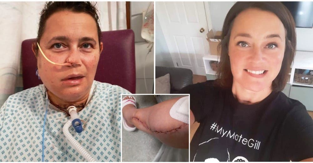 Acude a urgencias por un dolor en su rostro y termina sin parte de su mandíbula y su pierna Acude a urgencias por un dolor en su rostro y termina sin parte de su mandíbula y su pierna