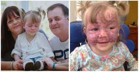 Señalan injustamente a los padres de la niña que tiene marcas en su rostro y no puede caminar
