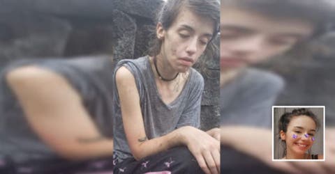 A los 24 años muestra su nueva apariencia tras superar su adicción a las drogas