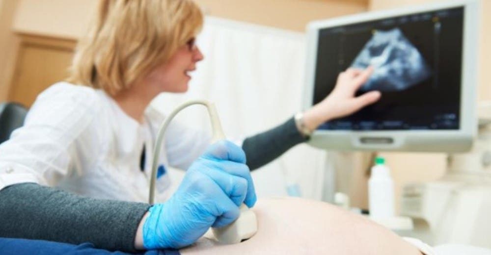 Causa conmoción la ley que prohíbe interrumpir el embarazo de bebés con Síndrome de Down Causa conmoción la ley que prohíbe interrumpir el embarazo de bebés con Síndrome de Down