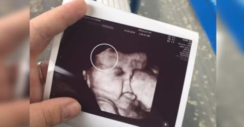 La apariencia de su segundo bebé dejó a todos en shock en la sala de partos
