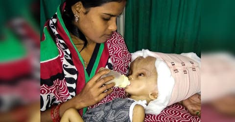 A este bebé de 7 meses muchos lo señalan por tener la cabeza más grande del mundo