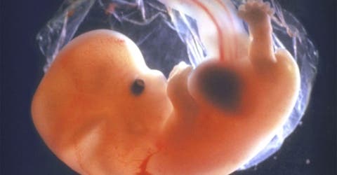 «Un embrión no es una persona» – Las polémicas declaraciones de un doctor en ciencias